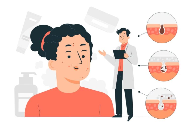 Comprehensive Management of Acne Vulgaris: Integrating Non-Antibiotic Therapies to Mitigate Resistance and Drug-Induced Discomfort and Pain Management